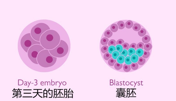 分娩