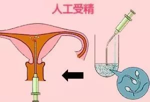 孕妇