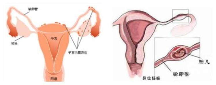 分娩镇痛体验仪