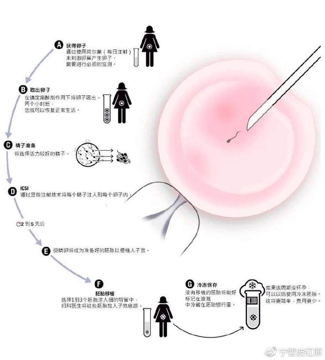 分娩