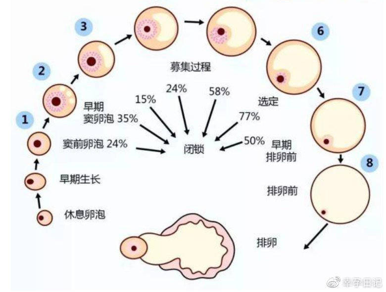 分娩宫缩