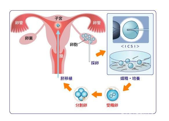 新生儿