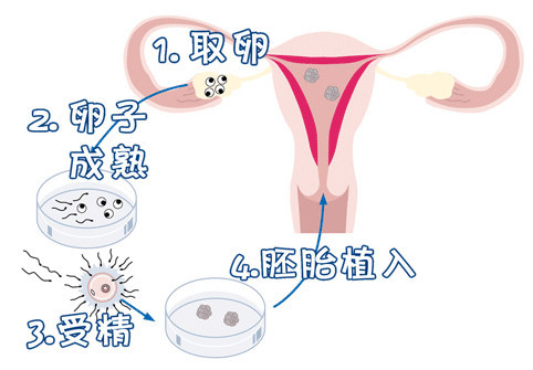 分娩