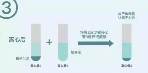 刚出生婴儿母乳喂养时间