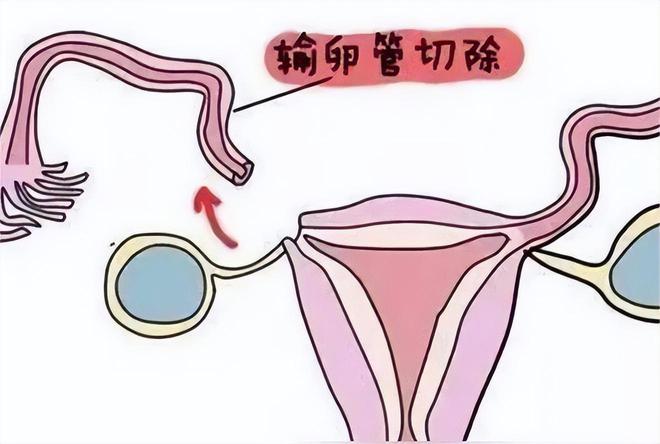 郑州试管婴儿价格