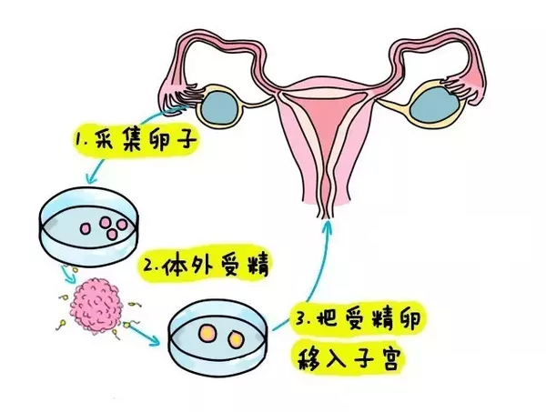 哈尔滨捐卵公司排名